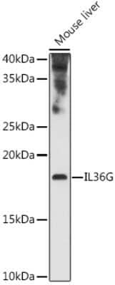 Western Blot: IL-36 gamma/IL-1F9 Antibody [NBP3-03323] - Western blot analysis of extracts of various cell lines, using IL-36 gamma/IL-1F9 antibody (NBP3-03323) at 1:1000 dilution. Secondary antibody: HRP Goat Anti-Rabbit IgG (H+L) at 1:10000 dilution. Lysates/proteins: 25ug per lane. Blocking buffer: 3% nonfat dry milk in TBST. Detection: ECL Enhanced Kit. Exposure time: 180s.